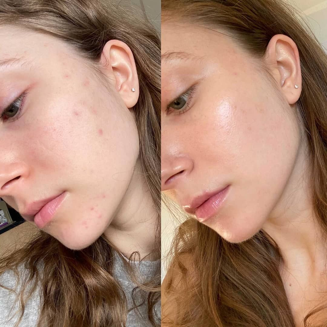 Vitamin illuminating Serum