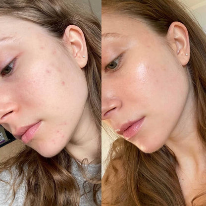 Vitamin illuminating Serum